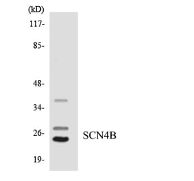 Western Blot - Anti-SCN4B Antibody (R12-3483) - Antibodies.com