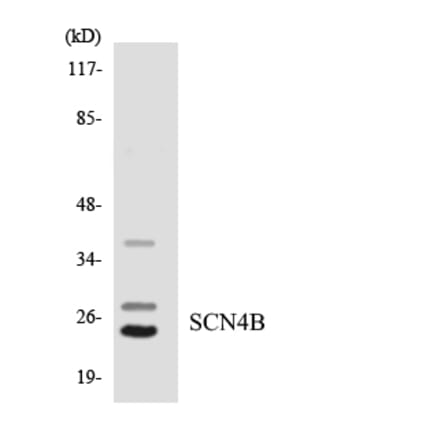 Western Blot - Anti-SCN4B Antibody (R12-3483) - Antibodies.com
