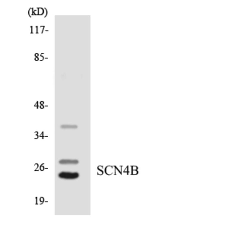 Western Blot - Anti-SCN4B Antibody (R12-3483) - Antibodies.com