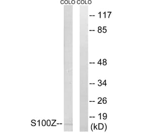 Western Blot - Anti-S100Z Antibody (C18058) - Antibodies.com