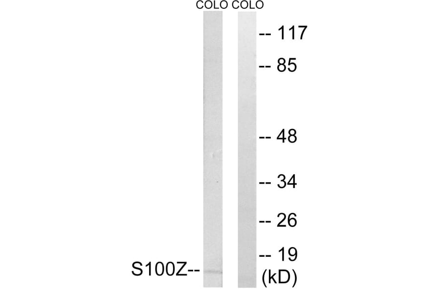 Western Blot - Anti-S100Z Antibody (C18058) - Antibodies.com