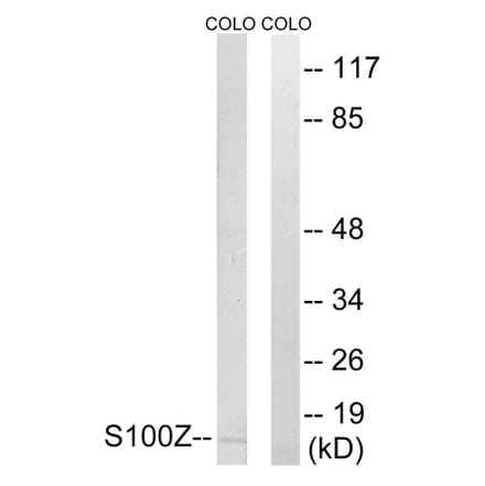 Western Blot - Anti-S100Z Antibody (C18058) - Antibodies.com