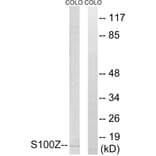 Western Blot - Anti-S100Z Antibody (C18058) - Antibodies.com