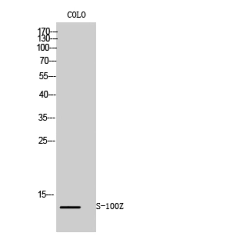 Western Blot - Anti-S100Z Antibody (C18058) - Antibodies.com