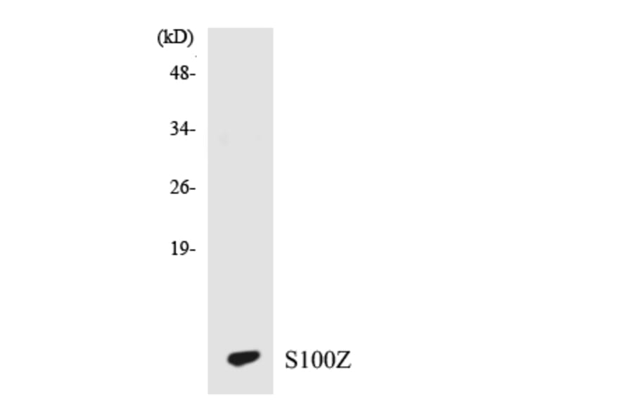 Western Blot - Anti-S100Z Antibody (R12-3477) - Antibodies.com