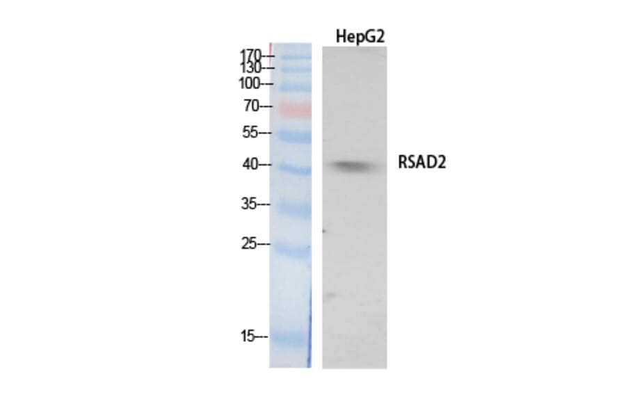 Western Blot - Anti-RSAD2 Antibody (C30990) - Antibodies.com