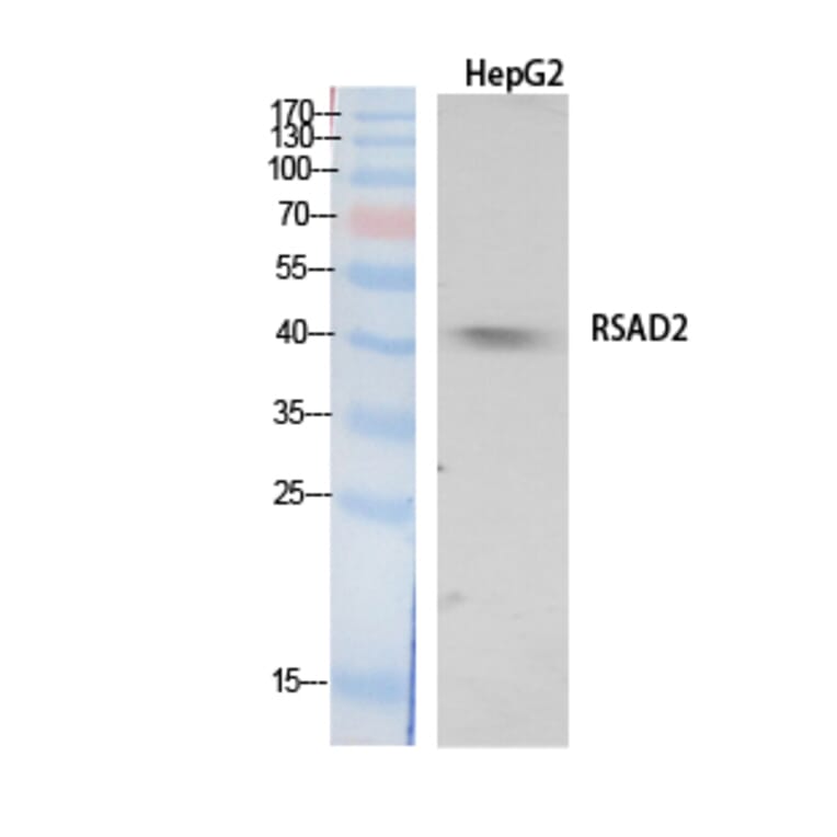 Western Blot - Anti-RSAD2 Antibody (C30990) - Antibodies.com