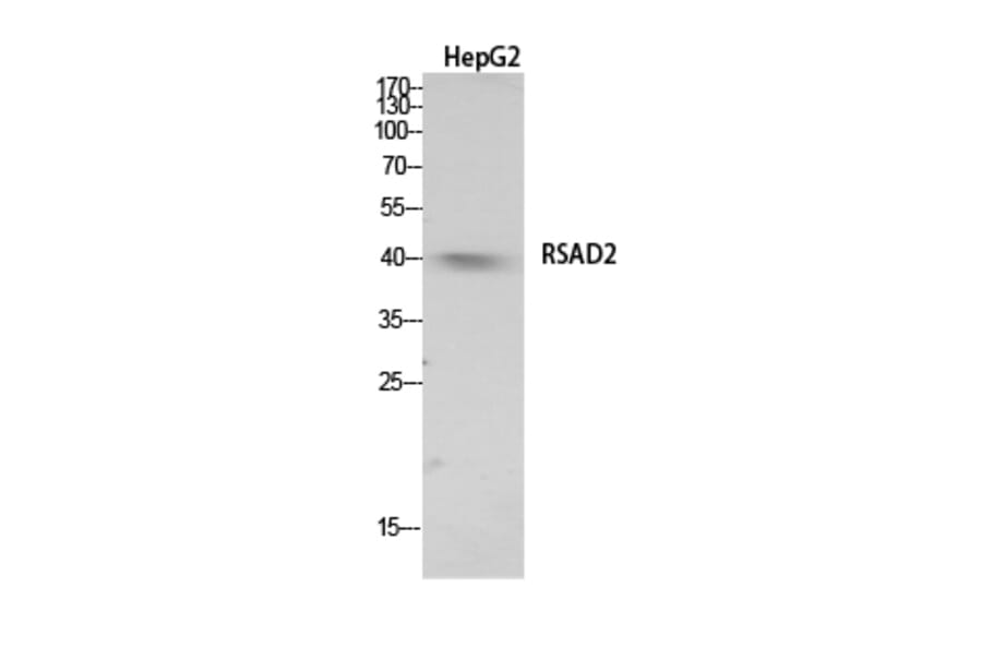 Western Blot - Anti-RSAD2 Antibody (C30990) - Antibodies.com
