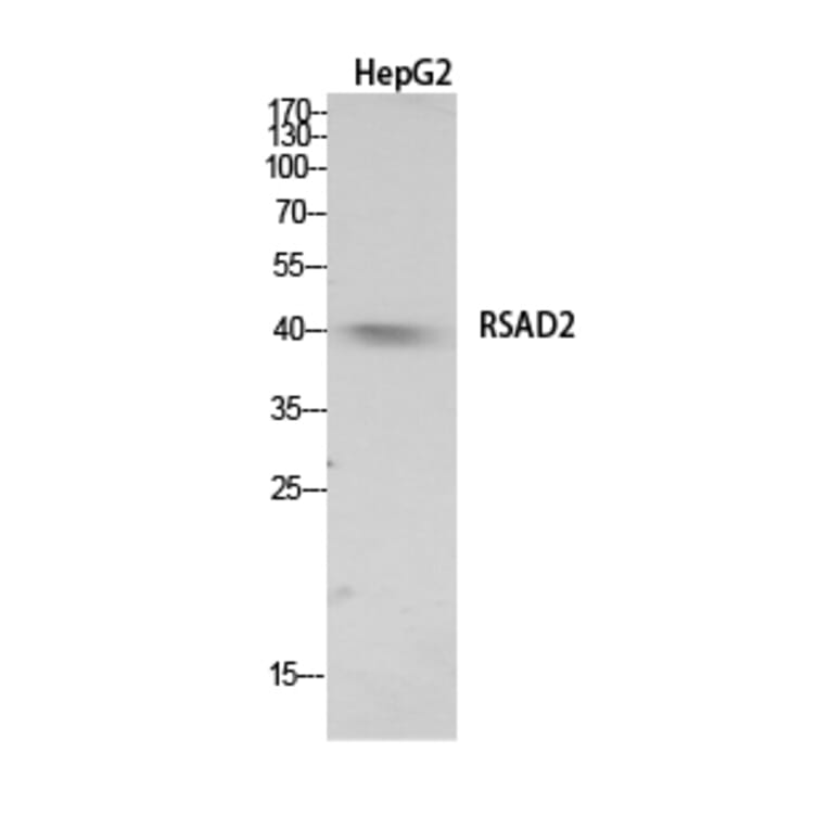 Western Blot - Anti-RSAD2 Antibody (C30990) - Antibodies.com