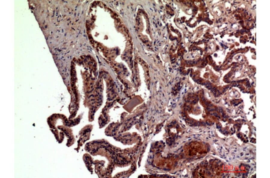 Immunohistochemistry - Anti-RSAD2 Antibody (C30990) - Antibodies.com