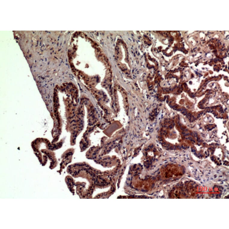 Immunohistochemistry - Anti-RSAD2 Antibody (C30990) - Antibodies.com