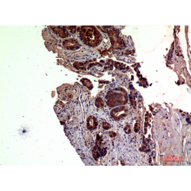 Immunohistochemistry - Anti-RSAD2 Antibody (C30990) - Antibodies.com