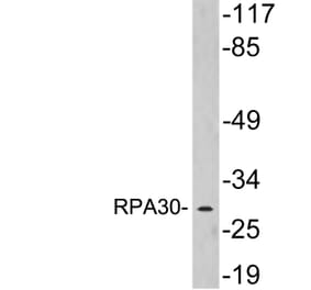 Western Blot - Anti-RPA30 Antibody (R12-2336) - Antibodies.com