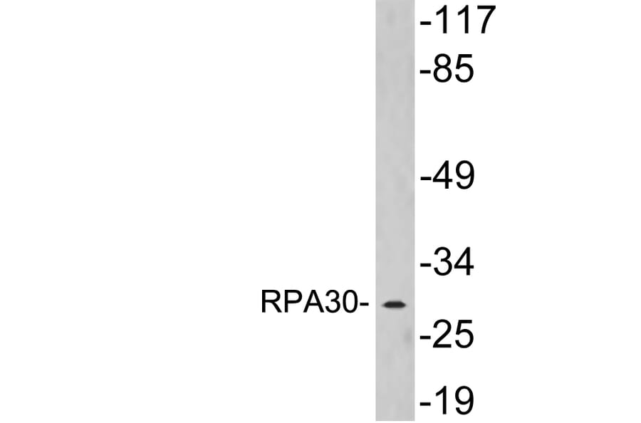 Western Blot - Anti-RPA30 Antibody (R12-2336) - Antibodies.com