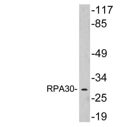 Western Blot - Anti-RPA30 Antibody (R12-2336) - Antibodies.com