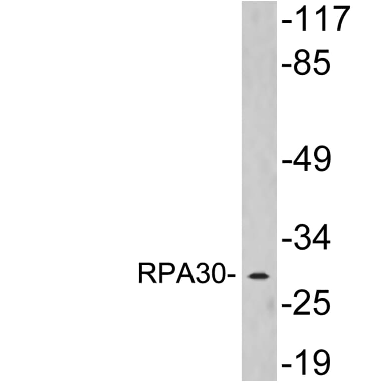 Western Blot - Anti-RPA30 Antibody (R12-2336) - Antibodies.com
