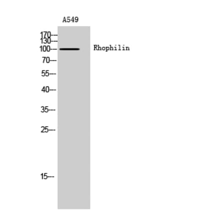Western Blot - Anti-RHPN1 Antibody (C18403) - Antibodies.com