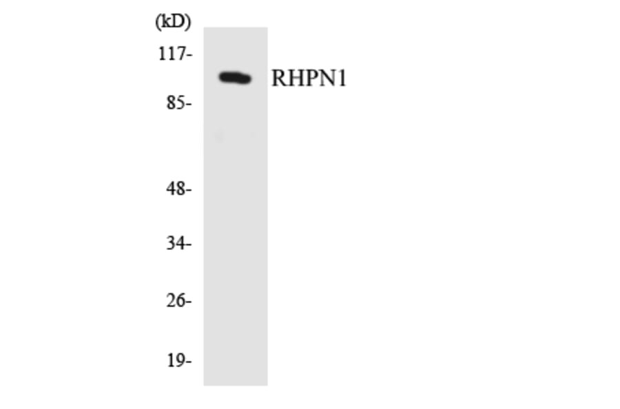 Western Blot - Anti-RHPN1 Antibody (R12-3441) - Antibodies.com