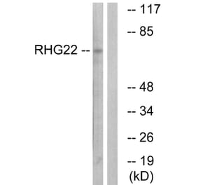 Western Blot - Anti-RHG22 Antibody (C18371) - Antibodies.com