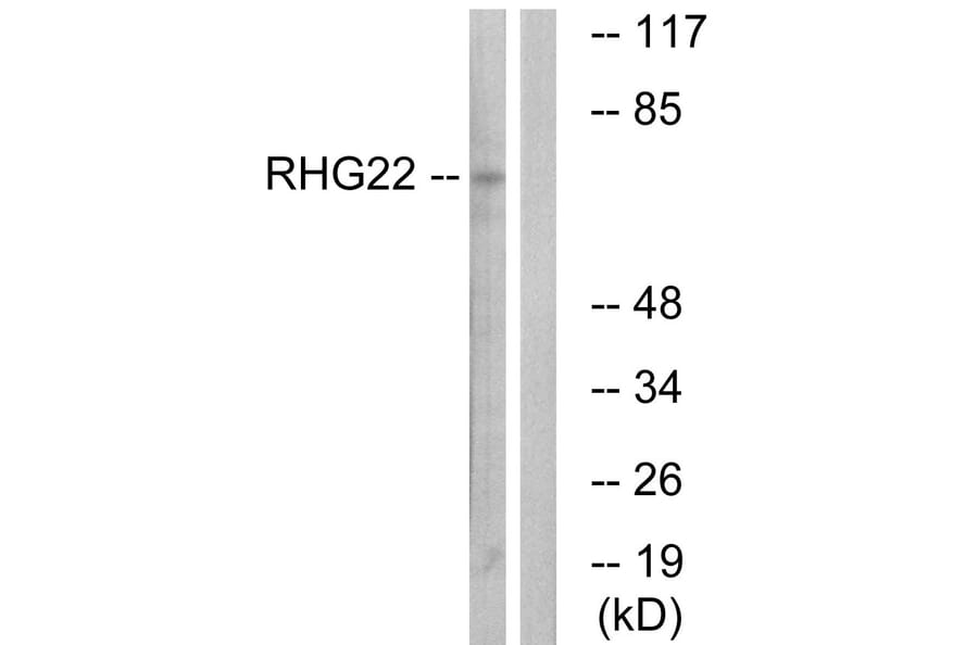 Western Blot - Anti-RHG22 Antibody (C18371) - Antibodies.com