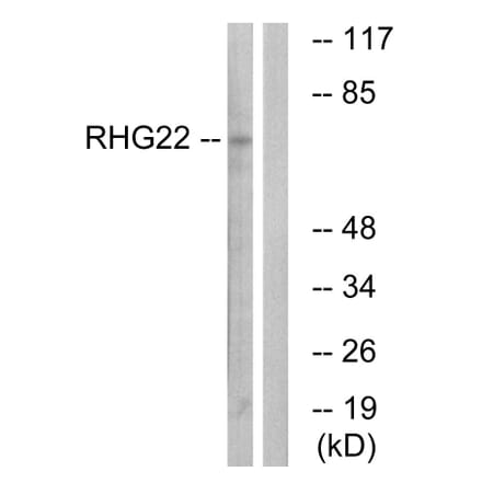 Western Blot - Anti-RHG22 Antibody (C18371) - Antibodies.com