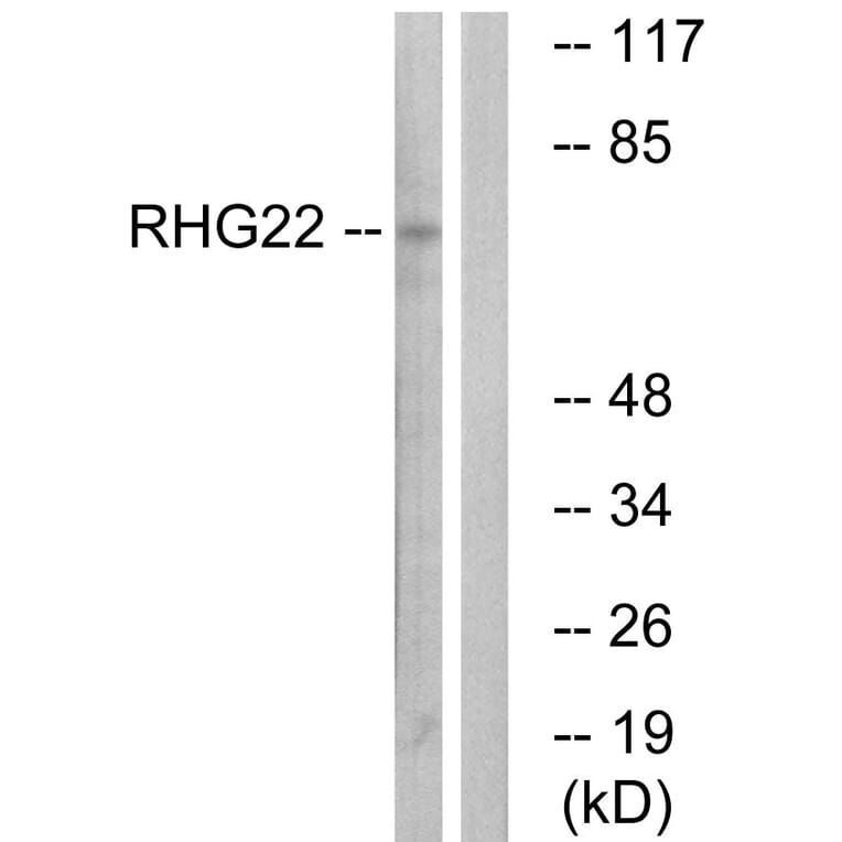 Western Blot - Anti-RHG22 Antibody (C18371) - Antibodies.com