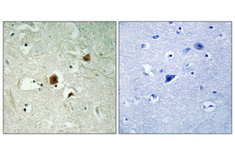 Immunohistochemistry - Anti-RHG22 Antibody (C18371) - Antibodies.com