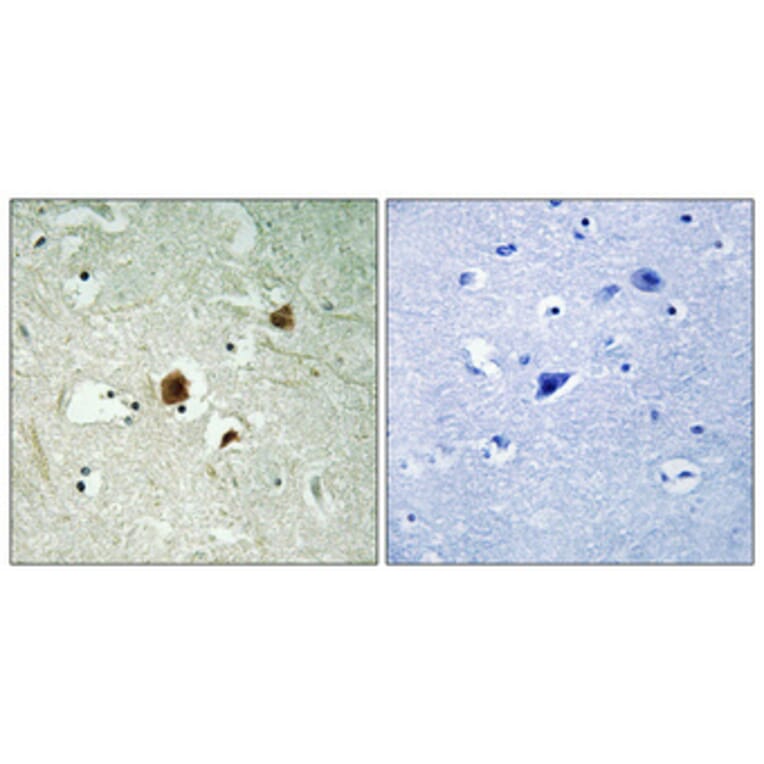 Immunohistochemistry - Anti-RHG22 Antibody (C18371) - Antibodies.com