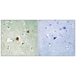 Immunohistochemistry - Anti-RHG22 Antibody (C18371) - Antibodies.com