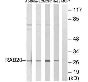 Western Blot - Anti-RAB20 Antibody (C18227) - Antibodies.com