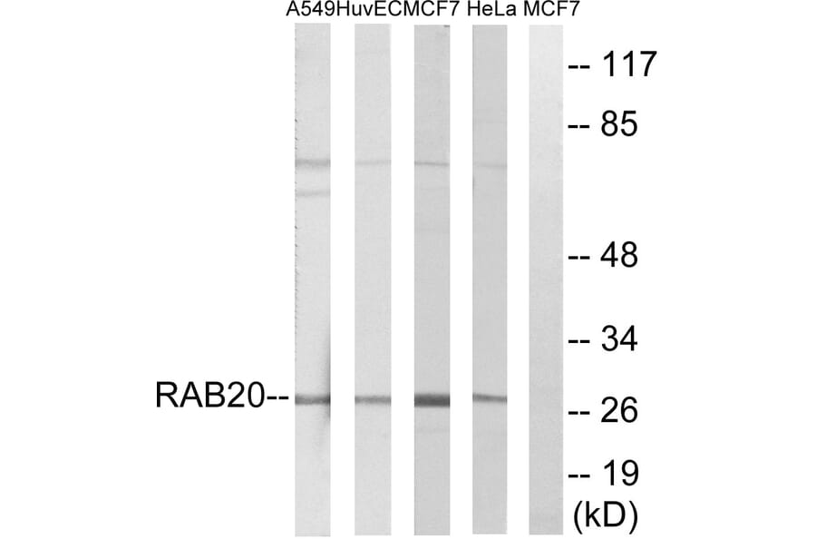 Western Blot - Anti-RAB20 Antibody (C18227) - Antibodies.com