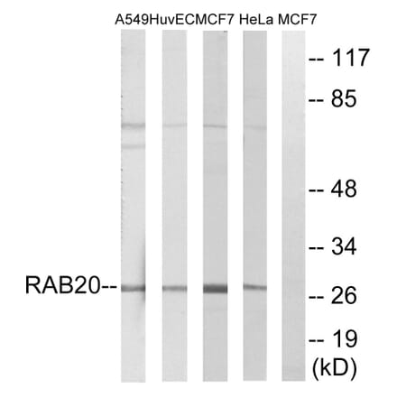 Western Blot - Anti-RAB20 Antibody (C18227) - Antibodies.com