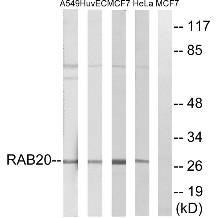 Western Blot - Anti-RAB20 Antibody (C18227) - Antibodies.com