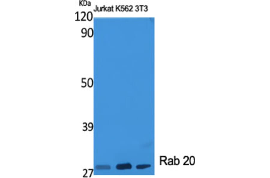 Western Blot - Anti-RAB20 Antibody (C18227) - Antibodies.com
