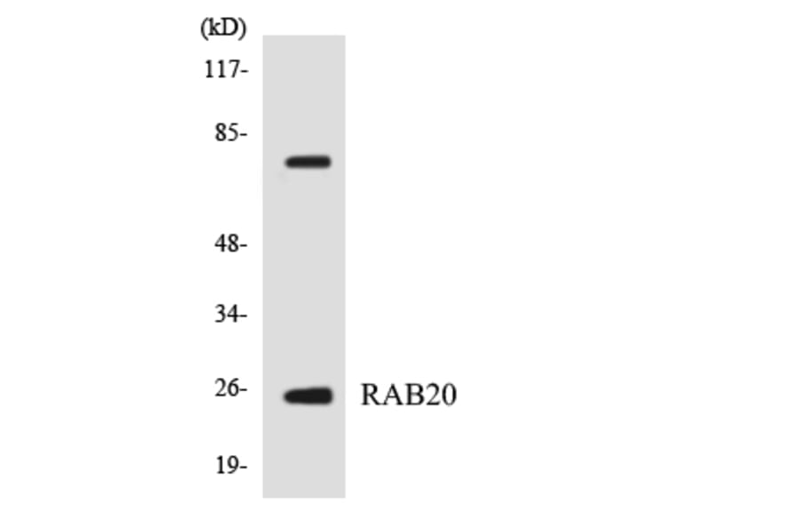 Western Blot - Anti-RAB20 Antibody (R12-3388) - Antibodies.com