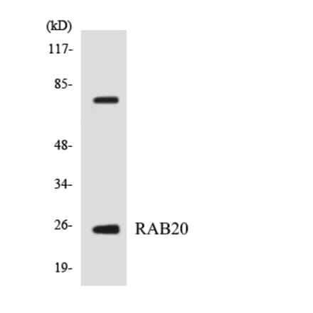 Western Blot - Anti-RAB20 Antibody (R12-3388) - Antibodies.com