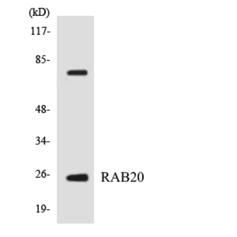 Western Blot - Anti-RAB20 Antibody (R12-3388) - Antibodies.com