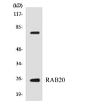 Western Blot - Anti-RAB20 Antibody (R12-3388) - Antibodies.com