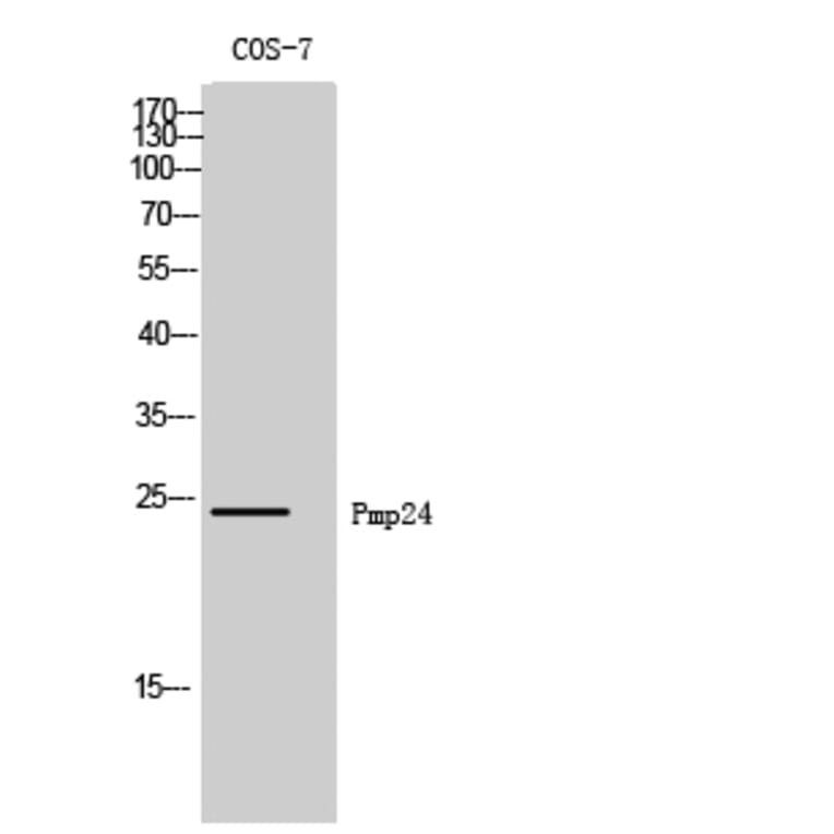 Western Blot - Anti-PXMP4 Antibody (C17633) - Antibodies.com