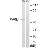Western Blot - Anti-PVRL4 Antibody (C17761) - Antibodies.com