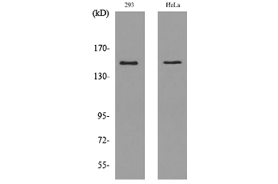 Western Blot - Anti-PTPRJ Antibody (C30482) - Antibodies.com