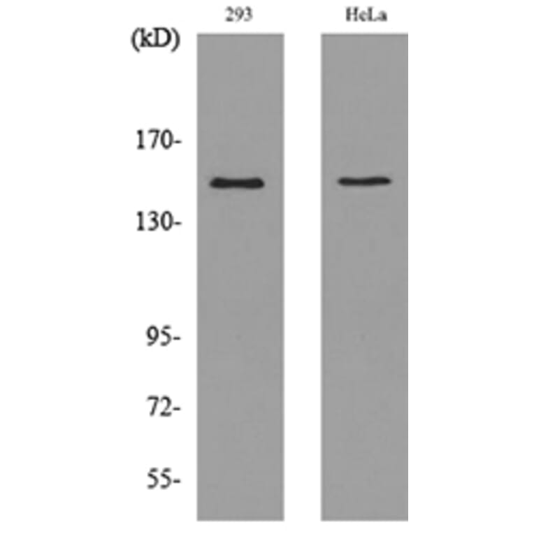 Western Blot - Anti-PTPRJ Antibody (C30482) - Antibodies.com