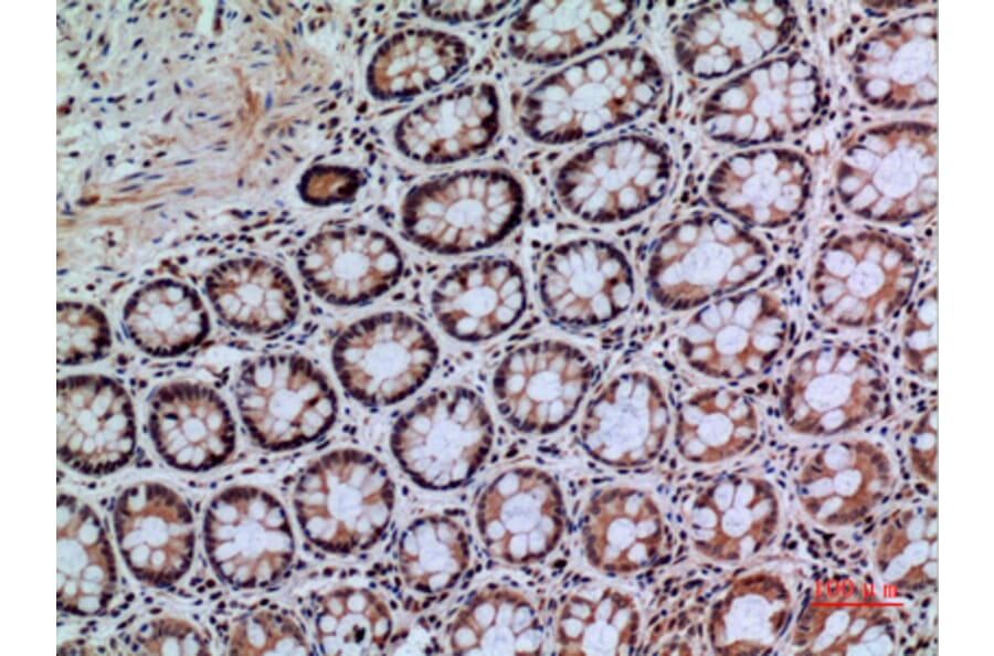 Immunohistochemistry - Anti-PTPRJ Antibody (C30482) - Antibodies.com