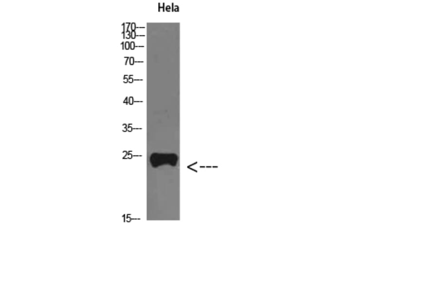 Western Blot - Anti-PTHLH Antibody (C30805) - Antibodies.com