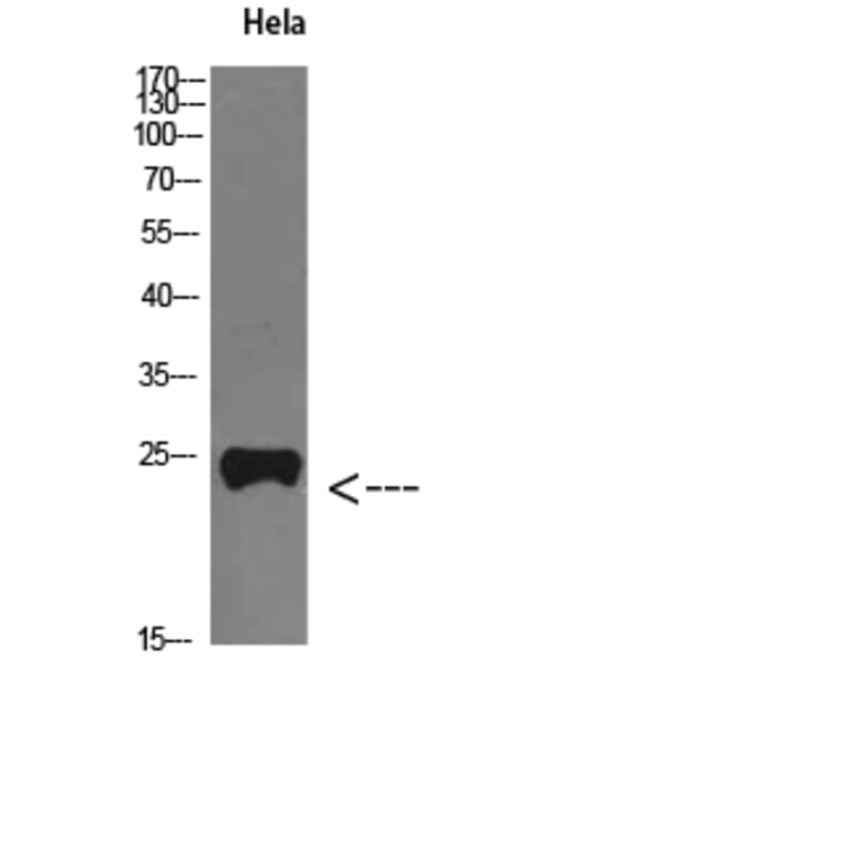 Western Blot - Anti-PTHLH Antibody (C30805) - Antibodies.com