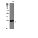 Western Blot - Anti-PTHLH Antibody (C30805) - Antibodies.com