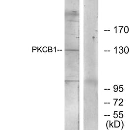 Western Blot - Anti-PKCB1 Antibody (C11882) - Antibodies.com