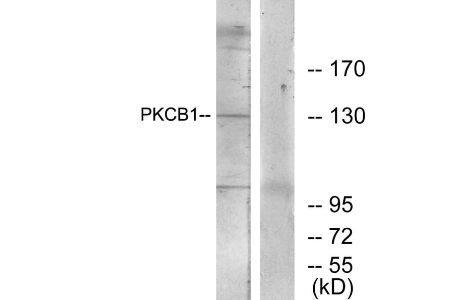 Western Blot - Anti-PKCB1 Antibody (C11882) - Antibodies.com