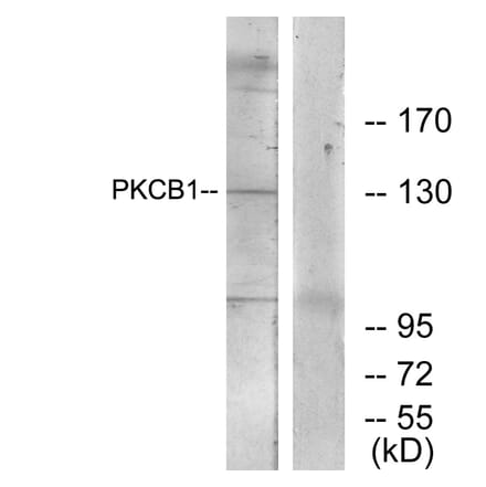 Western Blot - Anti-PKCB1 Antibody (C11882) - Antibodies.com