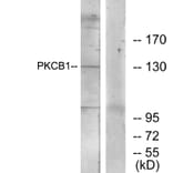 Western Blot - Anti-PKCB1 Antibody (C11882) - Antibodies.com
